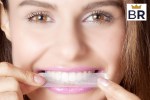 what are the best teeth whitening strips